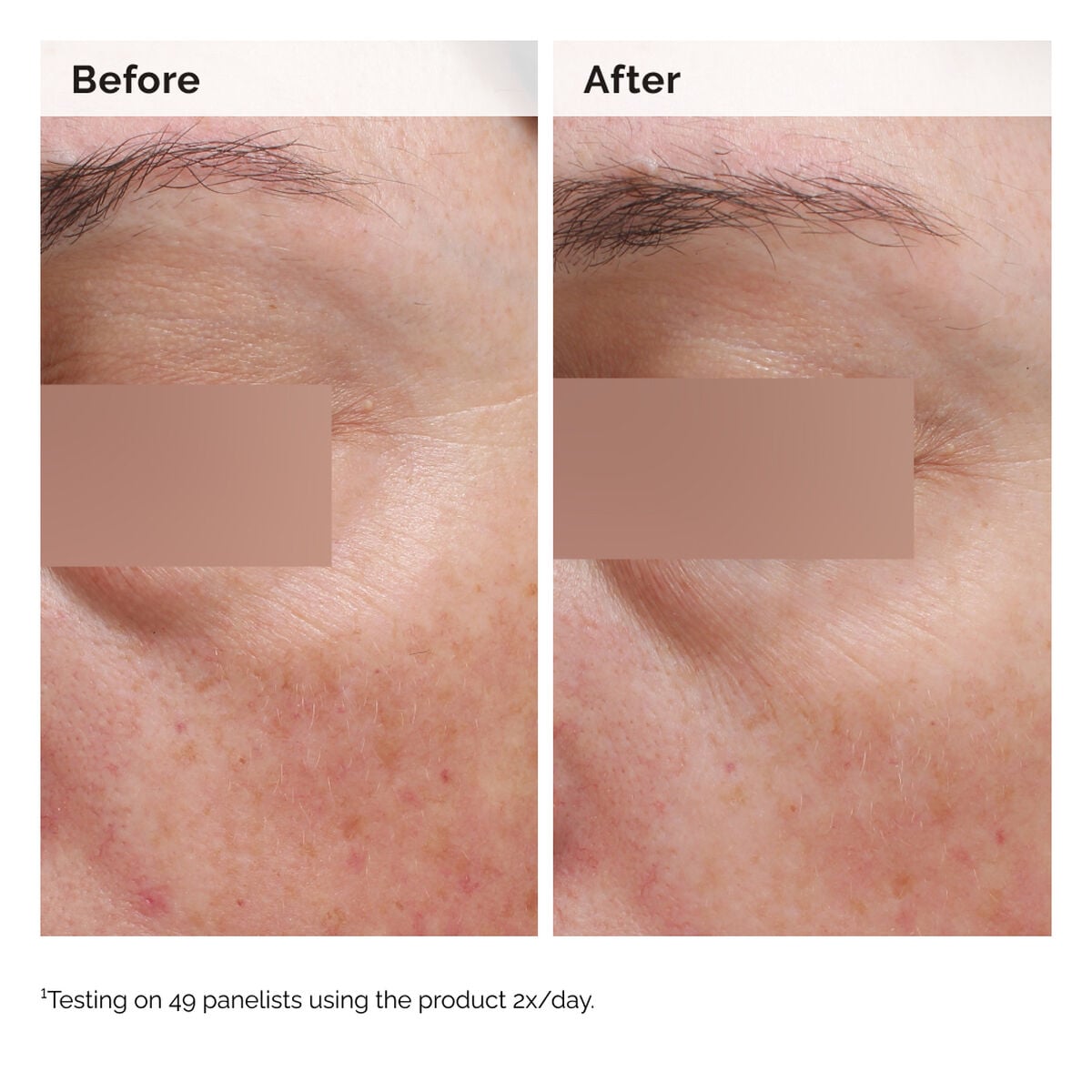 niacinamide-5-face-and-body-emulsion-s4 2024-08-23-ORD-Nia-5pct-Face-Body-B-A-Elasticity-Global-02-1x1.jpg