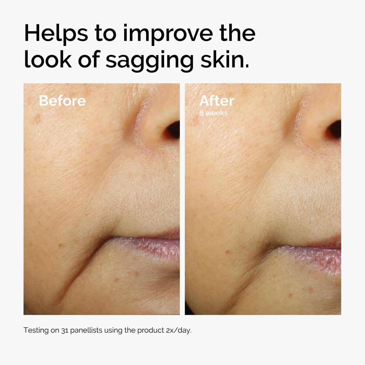 caffeine-3-escin-1-face-serum-w2 ord-caffeine-3pct-escin-1pct-face-serum-before-after-sagging.jpg
