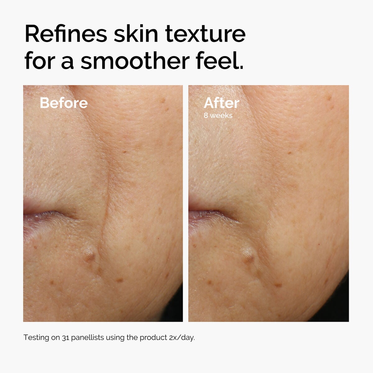 caffeine-3-escin-1-face-serum-w2 ord-caffeine-3pct-escin-1pct-face-serum-before-after-texture.jpg