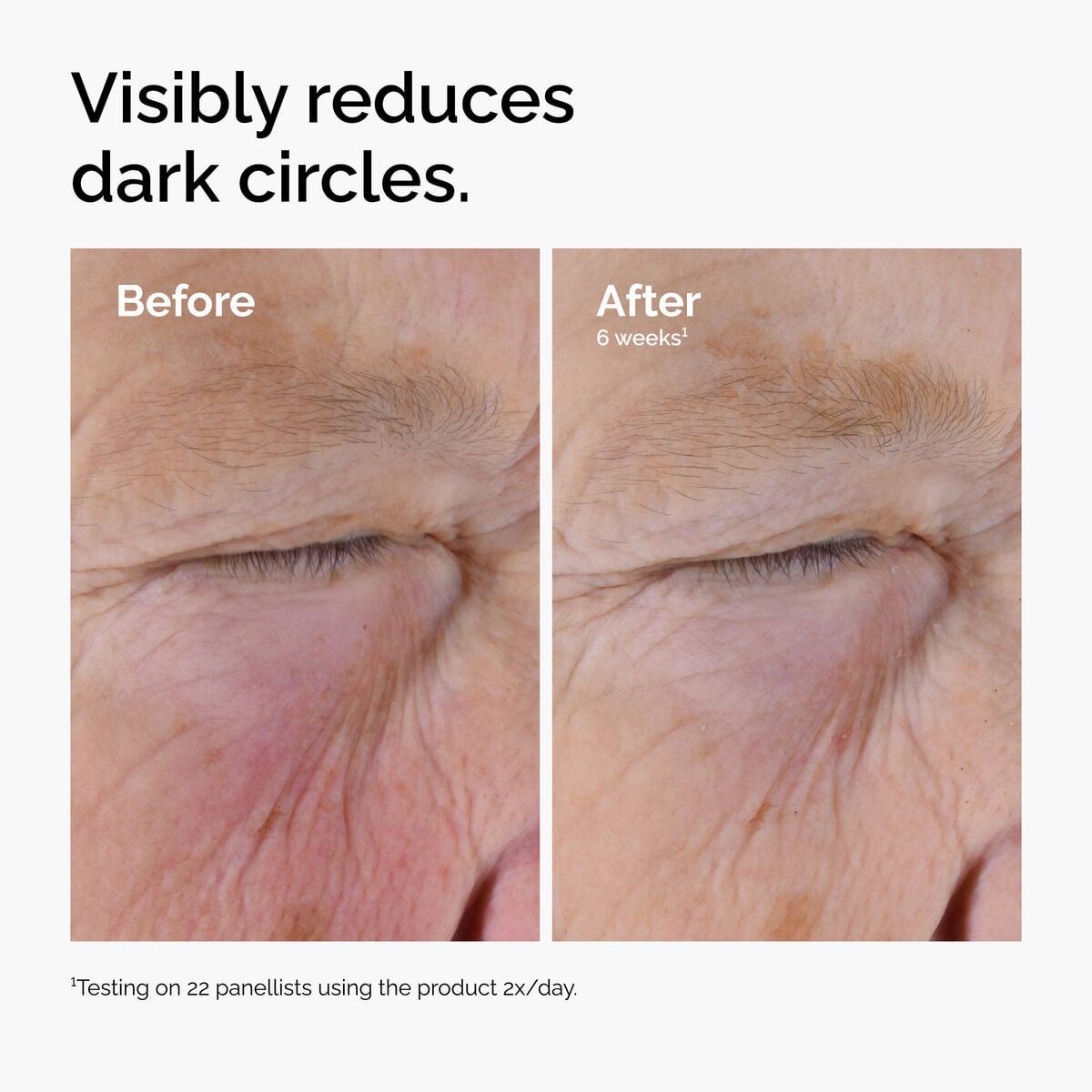 caffeine-solution-5-egcg-eye-serum-h0 ord-caffeine-solution-egcg-dark-circles-before-after.jpg