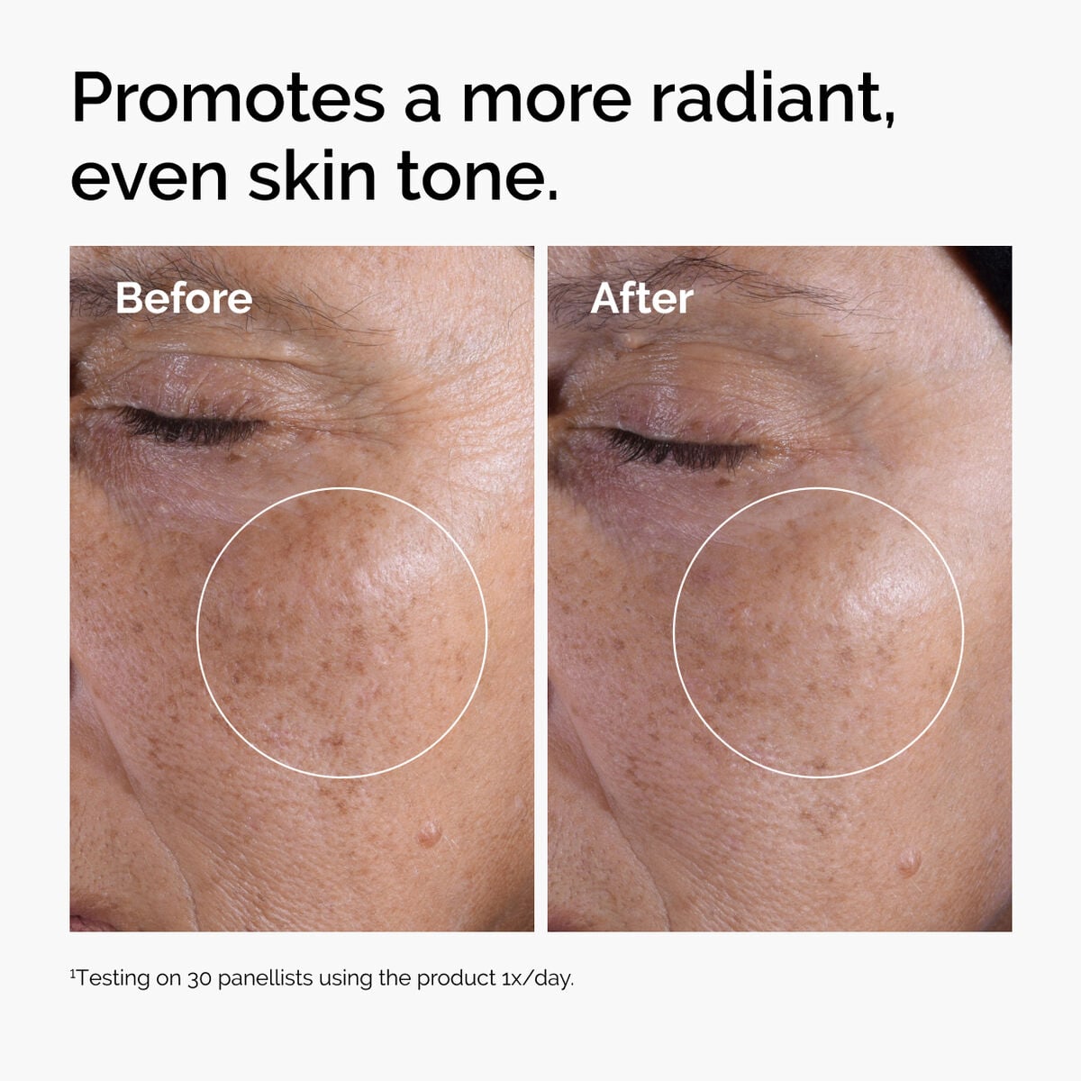 glycolic-acid-7-exfoliating-toner-c8 ord-glycolic-before-after-radiance.jpg