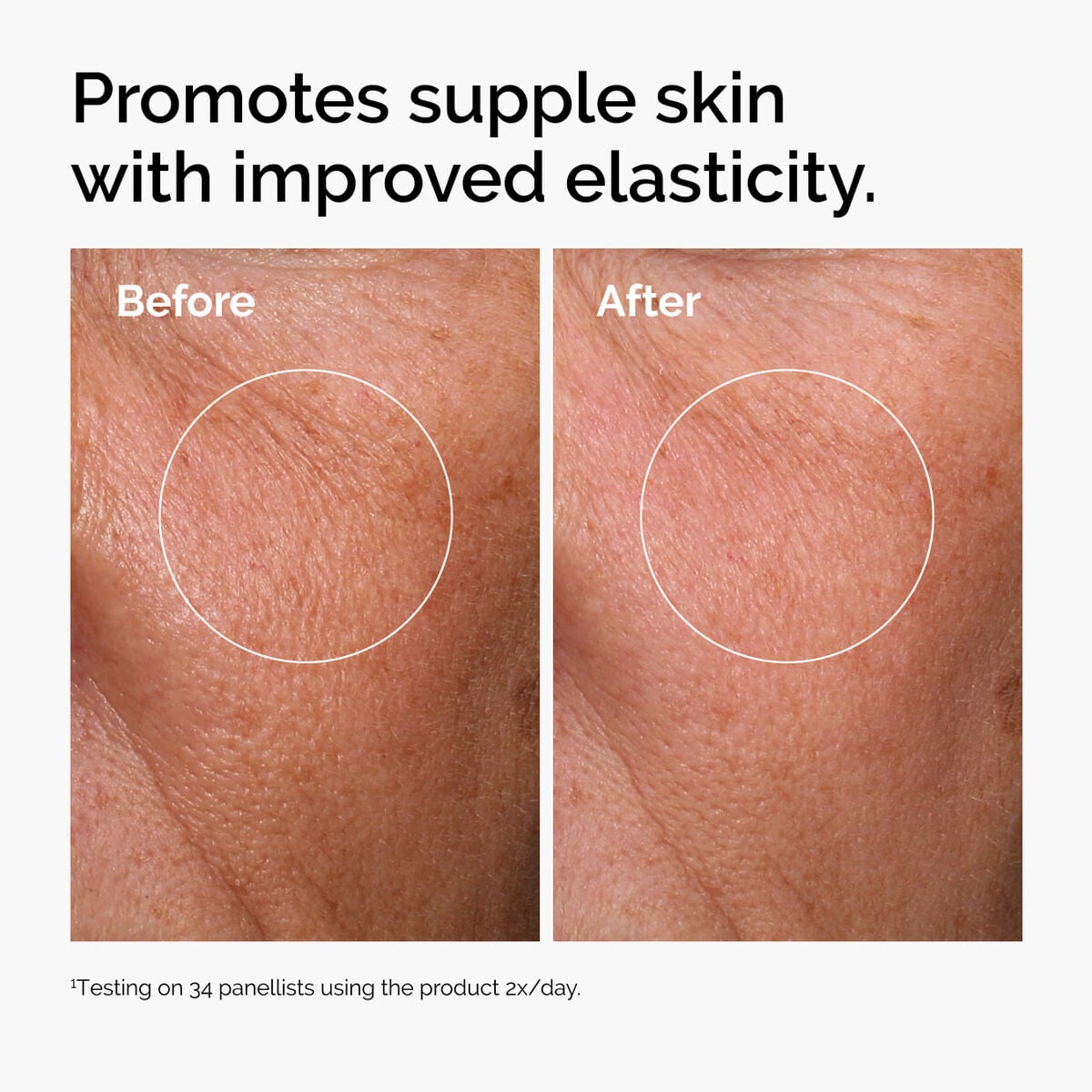 hyaluronic-acid-2-b5-with-ceramides-n2 ord-hyaluronic-acid-2pct-b5-hydrating-serum-before-after-elasticity.jpg