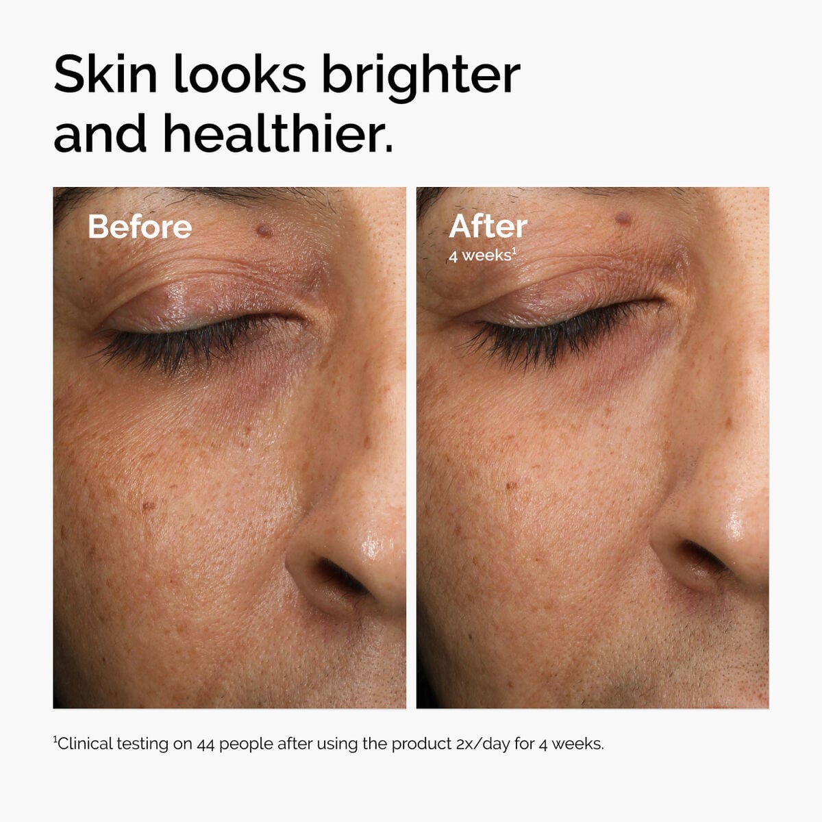 multi-antioxidant-radiance-serum-z1 ord-mars-before-after-healthy.jpg