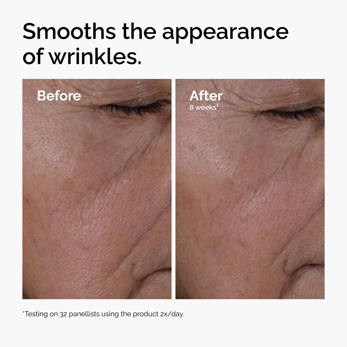 multi-peptide-ha-serum-n2 ord-multi-peptide-ha-serum-wrinkles-before-after.jpg