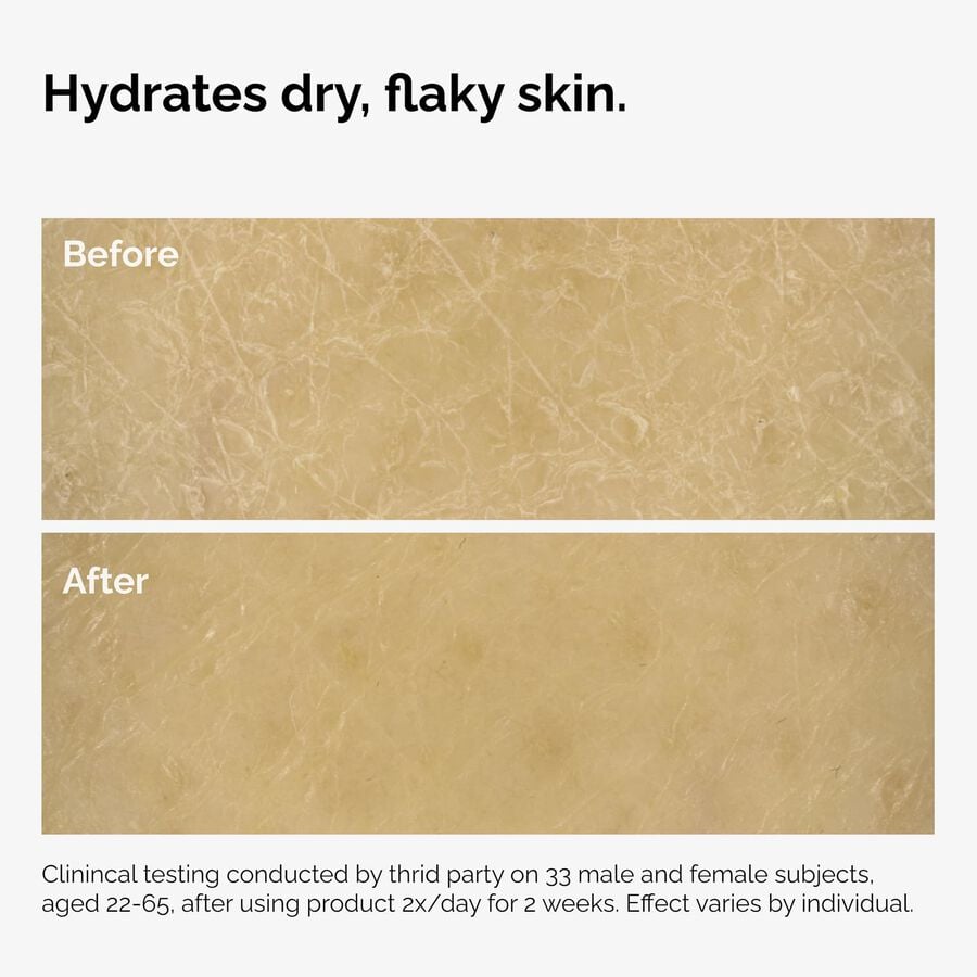 the-body-care-collection-r8 ord-natural-moisturizing-factors-inulin-body-before-after-graphic-02.jpg