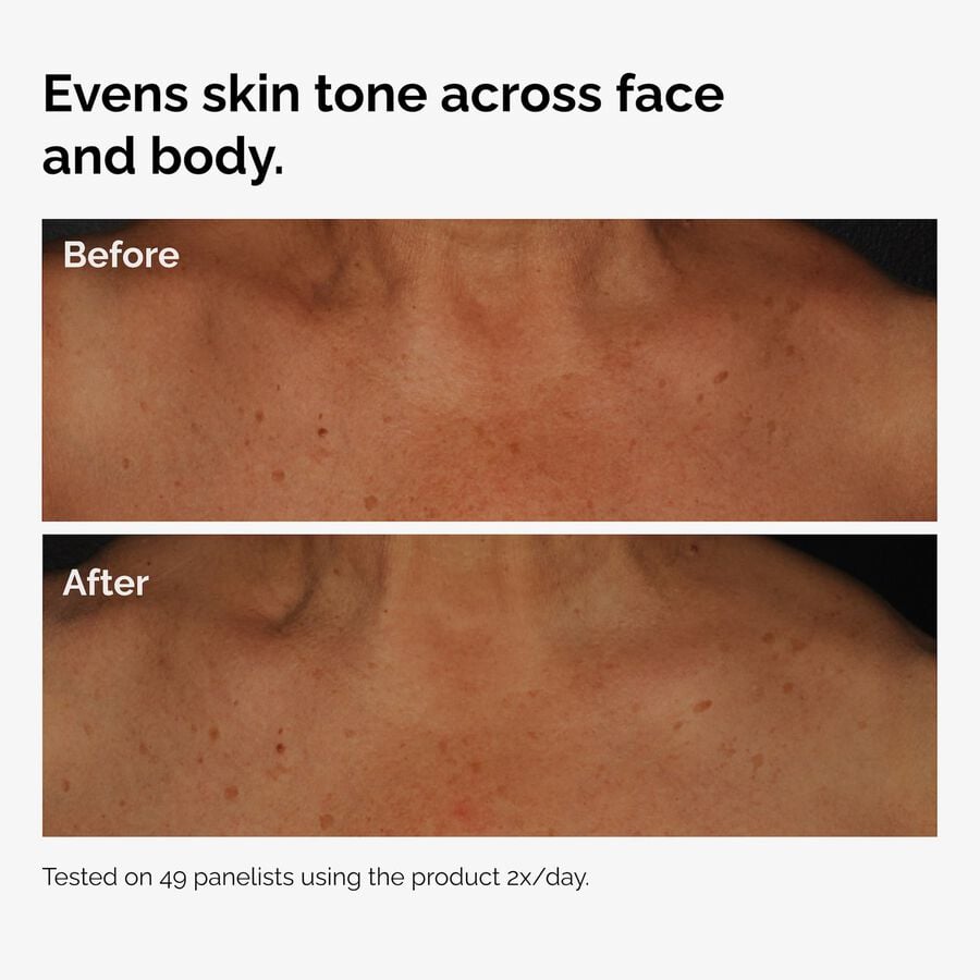 the-body-care-collection-r8 ord-niacinamide-face-body-serum-before-after-even-tone-graphic.jpg