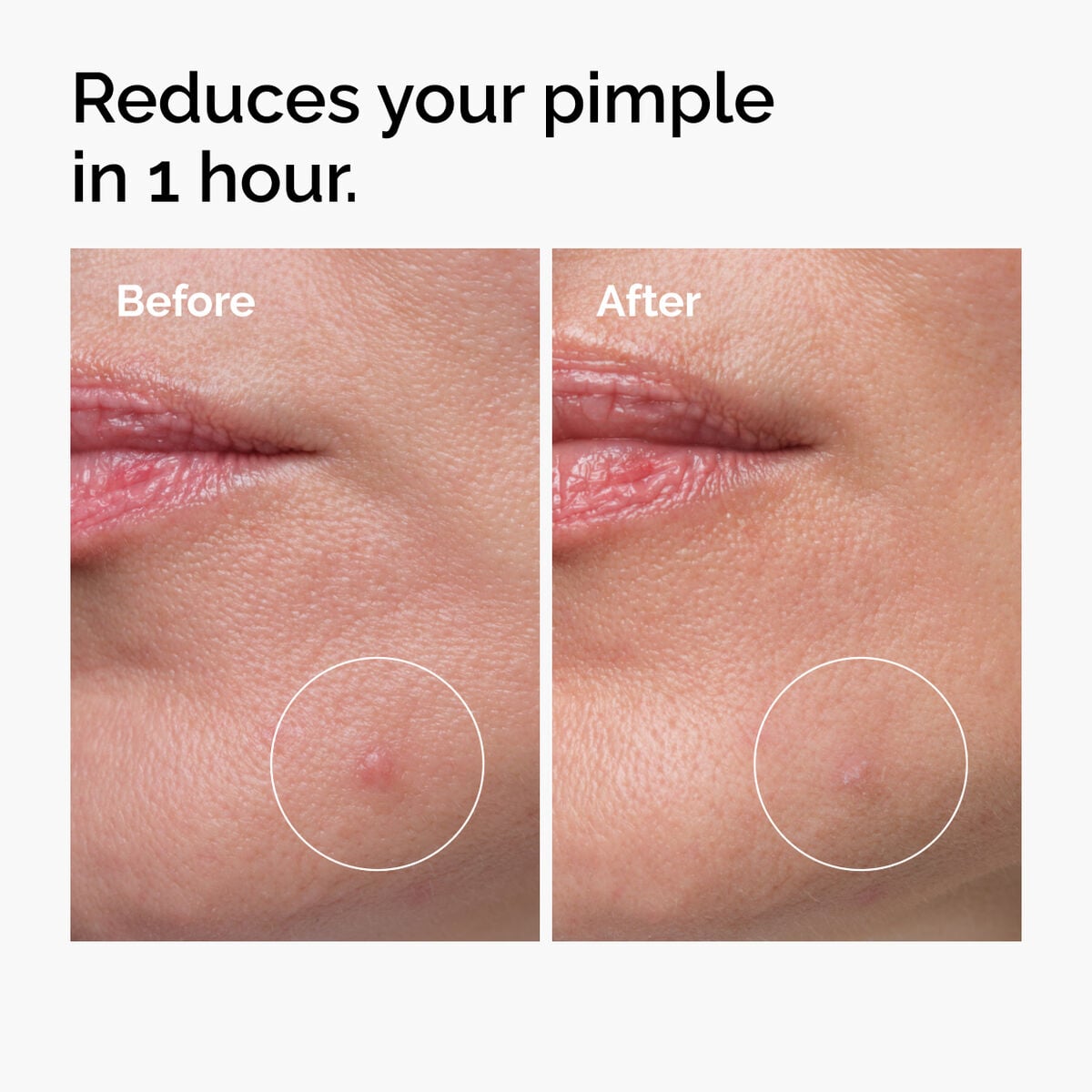 sulfur-10-powder-to-cream-concentrate-e0 ord-sulfur-10pct-powder-to-cream-concentrate-before-after-NA.jpg